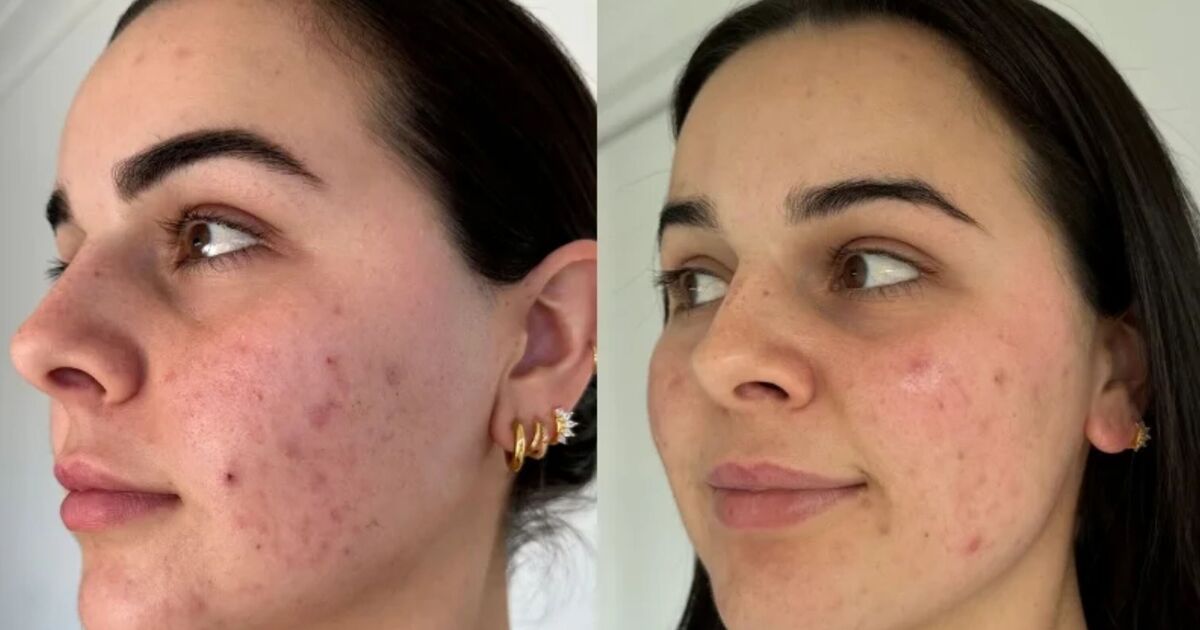 Shoppers praise £11.99 product as their ‘glowy skin’ gets ‘numerous compliments’